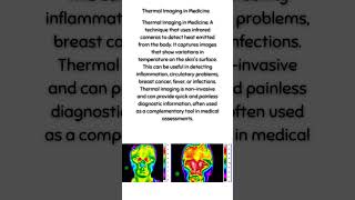 Thermal Imaging in Medicine [upl. by Eanar668]