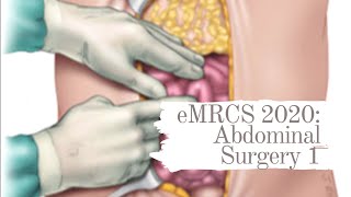 eMRCS 2020 Abdominal Surgery 1 [upl. by Yur]