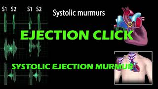 Ejection Click And Systolic Ejection Murmur pf Heart Sound [upl. by Elwira629]