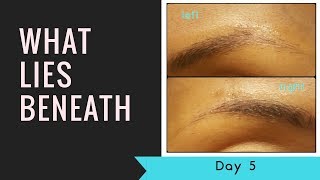 Microblading Day 5What Lies Beneath Pigment Fading [upl. by Gabrielli]