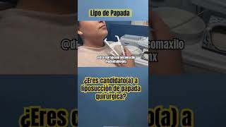 ¿Eres candidato a lipo de papada shorts lipo lipopapada liposuccion liposucciondepapada cmf [upl. by Ahsiam]