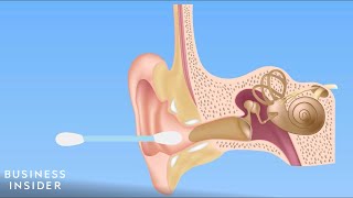 Forget QTips — Here’s How You Should Be Cleaning Your Ears [upl. by Annahsed326]