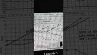 partogram Dr rania2 [upl. by Lapham518]