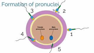 APGO Basic Sciences  Topic 19 Gestational Trophoblastic Disease [upl. by Anairotciv]