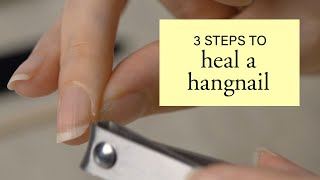 3 Steps to Heal a Hangnail [upl. by Ecyac]