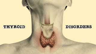 Thyroid Disorders [upl. by Bethezel]