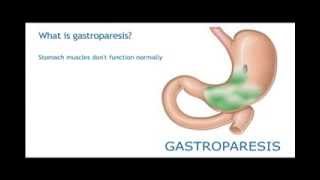 Gastroparesis [upl. by Filipe]