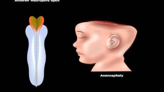 USMLE® Step 1 Neuroscience Development of CNS Animation [upl. by Enahsal]