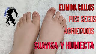 Sana tus pies agrietados secos y con hongos Remedio casero para pies con callos [upl. by Jeritah]