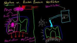 Negative vs Positive Pressure Ventilation [upl. by Valerio578]