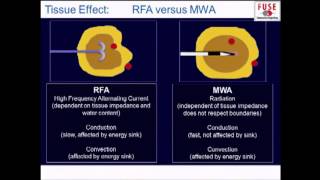 PG Fundamental Use of Surgical Energy FUSE Ablation Technologies  RFA Microwave HIFU [upl. by Longtin]