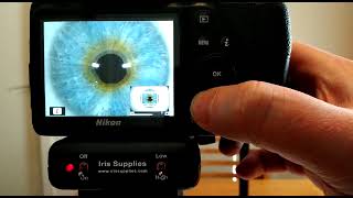 Taking an Iris Image through the LCD Screen  eyePIX Handheld Iridology Camera [upl. by Arrekahs482]