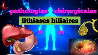 cours S3  Pathologies Chirurgicales et SI  Lithiases biliaires💊🩺💉🩸 شرح سهل 📚و 📚 مبسط للفهم [upl. by Tnert550]