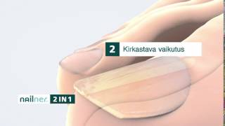 Nailner 2 IN 1 Nail Fungus treatment TV commercial FI2016 [upl. by Guevara]