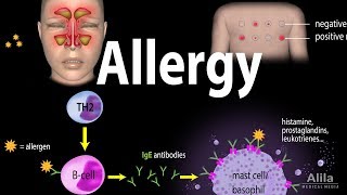 Allergy  Mechanism Symptoms Risk factors Diagnosis Treatment and Prevention Animation [upl. by Aiuqes586]