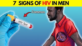 Signs of HIV in Men Early  How Do You Know if a Guy Has HIV [upl. by Ivanna386]