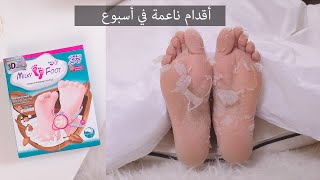 Milky Foot Review  أسهل وَأسرع طريقة لتقشير الأقدام وَ التخلص من القشور [upl. by Minardi]