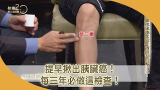 提早揪出胰臟癌！每三年必做這檢查！【聚焦20】第434集 [upl. by Anecuza821]