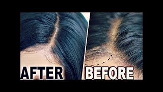 How To quotHIDE LACEquot amp Wig Cap Lace Wigs Fake Scalp Method  ORIGINAL CREATOR [upl. by Aicilat]