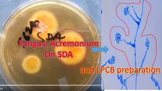 Fungus Acremonium on SDA and LPCB preparation [upl. by Dolan]