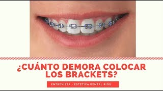 ¿Cuánto demora colocar los brackets  tercera parte [upl. by Airekal]