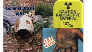 the Goiania Cesium 137 radiological accident [upl. by Eugenia609]