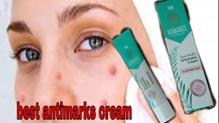 Nomarks cream review in hindi पिम्पल के निशान जले हुए कटे हुए के निशान मिटाए। beauty tips trick [upl. by Tori]