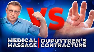 How to Treat Dupuytrens Contracture at Home  Homework For Patience [upl. by Pul32]