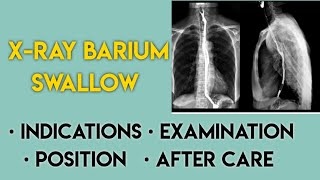 x ray barium swallow  indications of barium swallow test  barium swallow procedure [upl. by Basia]