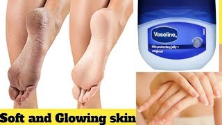 DIY Hand and Feet Whitening  Vaseline for hand and feet whitening  Vaseline remedy for Crack heels [upl. by Cynthie]