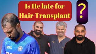 Mohammed Shamis Incredible Hair Transformation Exclusive Coverage of His Hair Transplant Journey [upl. by Margaretta205]