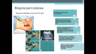 Biopsia Renal  Danna Calderón [upl. by Tomchay]