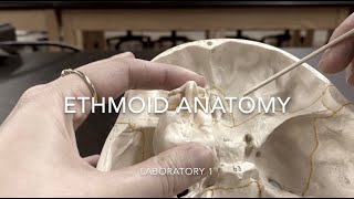 Ethmoid Anatomy [upl. by Baker]