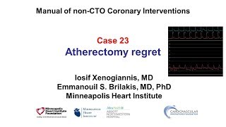 Case 23 PCI Manual Atherectomy regret [upl. by Mar136]