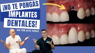 ¡No te pongas un Implante Dental sin ver este video [upl. by Nnor]