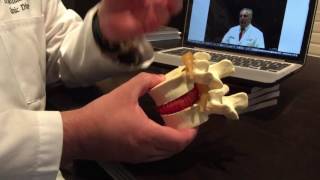 Disc Spine Center Disc Pump Mechanism Explained [upl. by Lean]