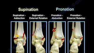 Ankle Fractures Lauge Hansen Introduction  Everything You Need To Know  Dr Nabil Ebraheim [upl. by Atteval909]