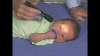 Neurological Examination of Newborn [upl. by Nilrev]