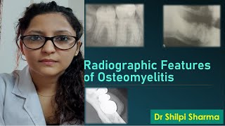 Radiographic Features of Osteomyelitis [upl. by Oravla922]