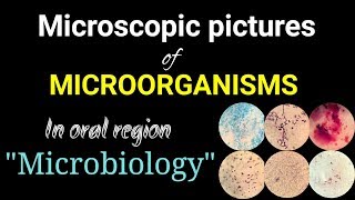 Microscopic pictures of microorganismsmicrobiology pictures of microorganismsDr Poojireddy [upl. by Eustazio]