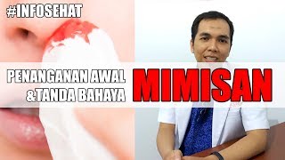 Penanganan Awal amp Tanda Bahaya dari Mimisan  Epistaksis [upl. by Irt999]