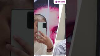 Success Story Alopecia Areata Treatment  Patient Testimonial  Dr Sonali Gupta [upl. by Dukey]