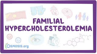 Familial hypercholesterolemia  an Osmosis Preview [upl. by Ethelbert]