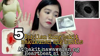 5 DAHILAN KUNG BAKIT NAWAWALAN NG HEART BEAT AT KUNG BAKIT NAKUKUNAN ANG ISANG BUNTIS [upl. by Eb23]