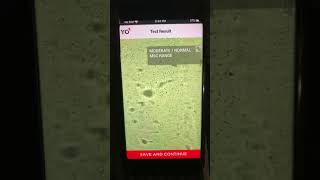 YO sperm test semen by iPhone [upl. by Darej]