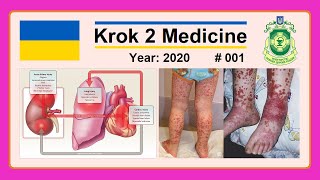 Krok 2 Medicine  Year 2020  001 Ministry of Public Health of Ukraine [upl. by Atisor]