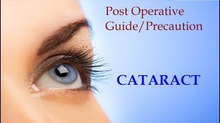 post operative precautioncare after cataract surgery HINDI [upl. by Aisital589]