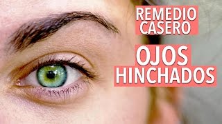 COMO QUITAR LOS OJOS HINCHADOS OJERAS Y BOLSAS EN LOS OJOS  YASMANY [upl. by Trilby]