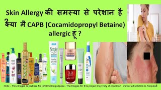 CAPB side effect capb skinallergy allergies cocamidopropylbetaine [upl. by Labinnah]