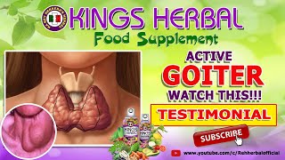 Active Goiter  KINGS Herbal Testimonial [upl. by Siramaj355]